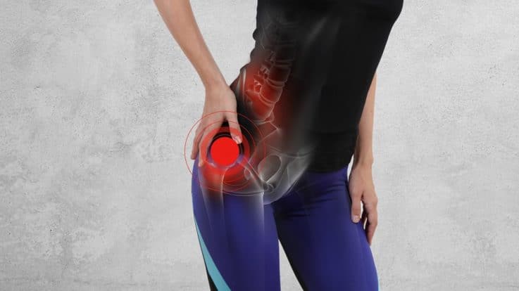 4 Facts About Total Hip Replacement Safety You Should Know